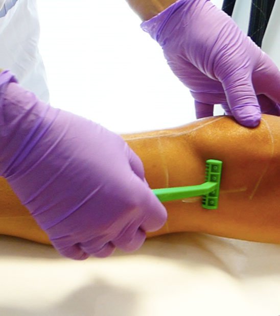 Déroulement d'une séance d'épilation laser à La Rochelle | Skin Clinic