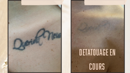 Neutral Rustic Before After Photos Facebook Post